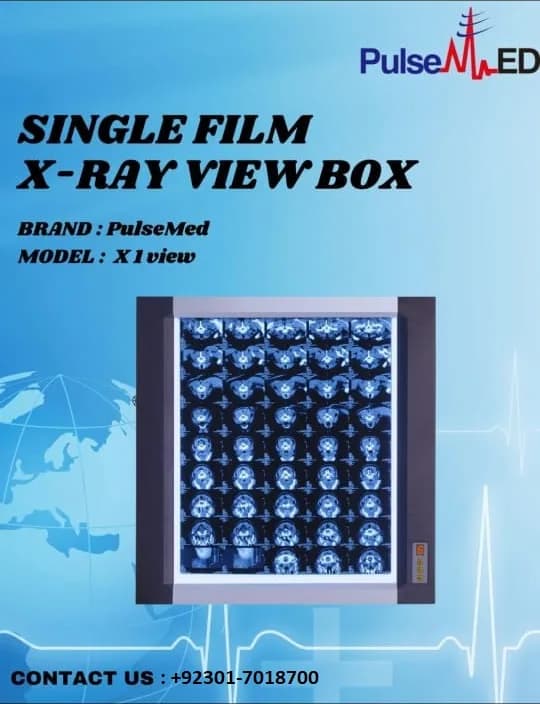 PULSEMED X1 VIEW Single Film X-Ray Viewer - Professional LED Illuminator for Hospitals & Clinics