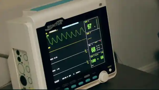 ECG