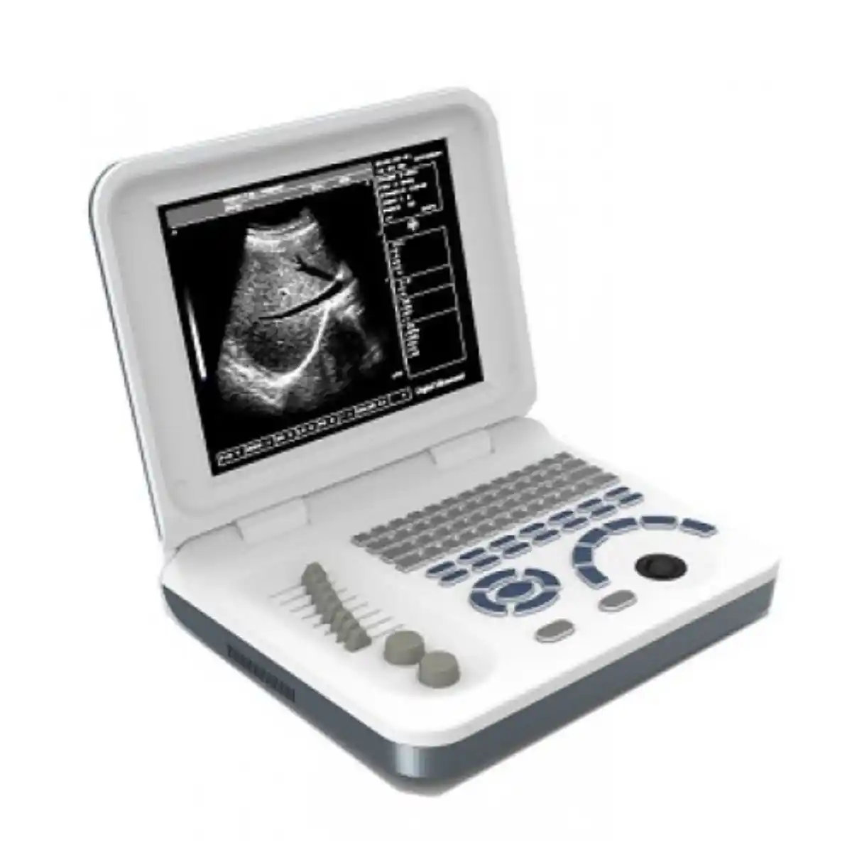 Ultrasound Machine Daignistic Scanner Ecomed EUS-6 China Medical